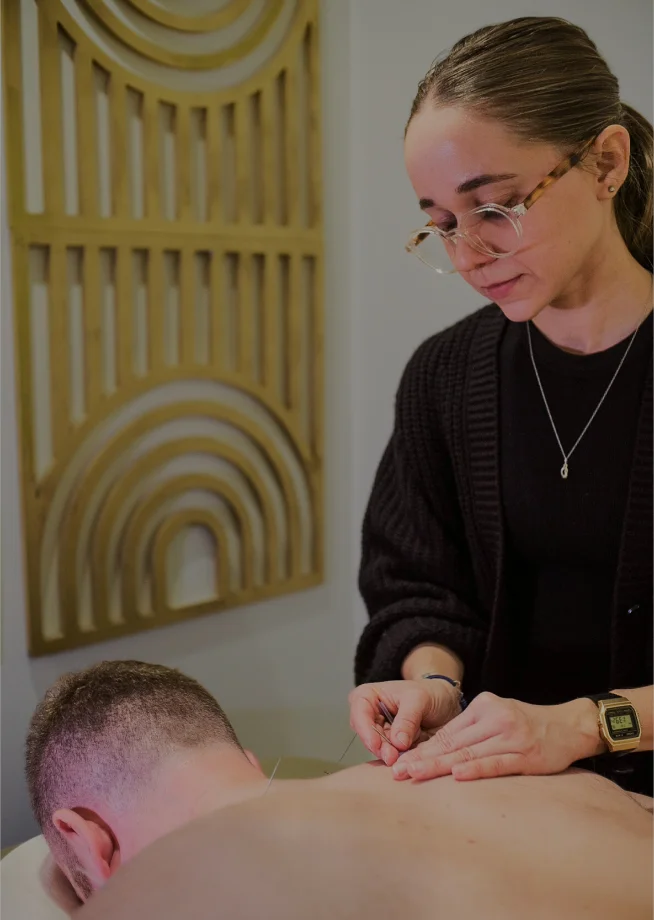 Acupuncture