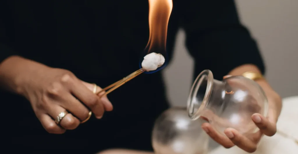 cupping therapy wicker park