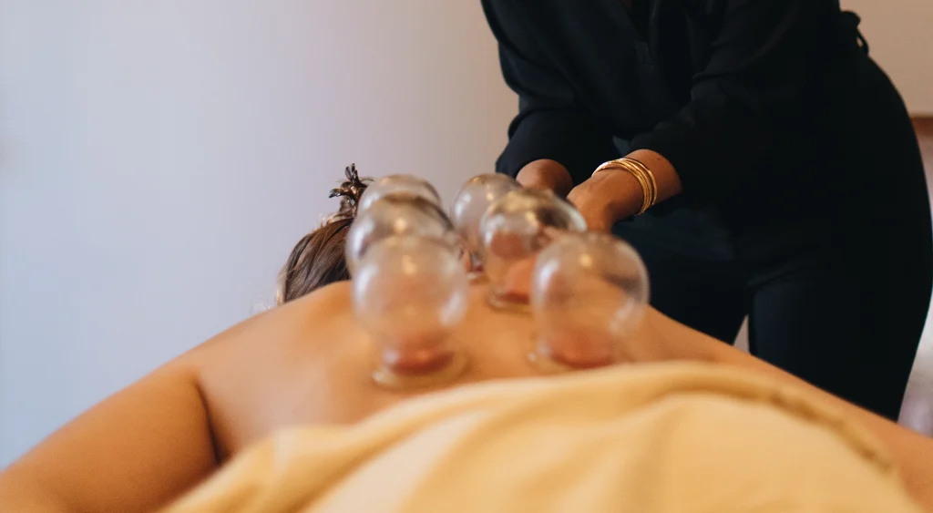 cupping therapy in wicker park